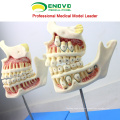 DENTAL22 (12604) Modelo de desarrollo de los dientes del feto de los niños de Huamn con 4 modelos dentales de las piezas